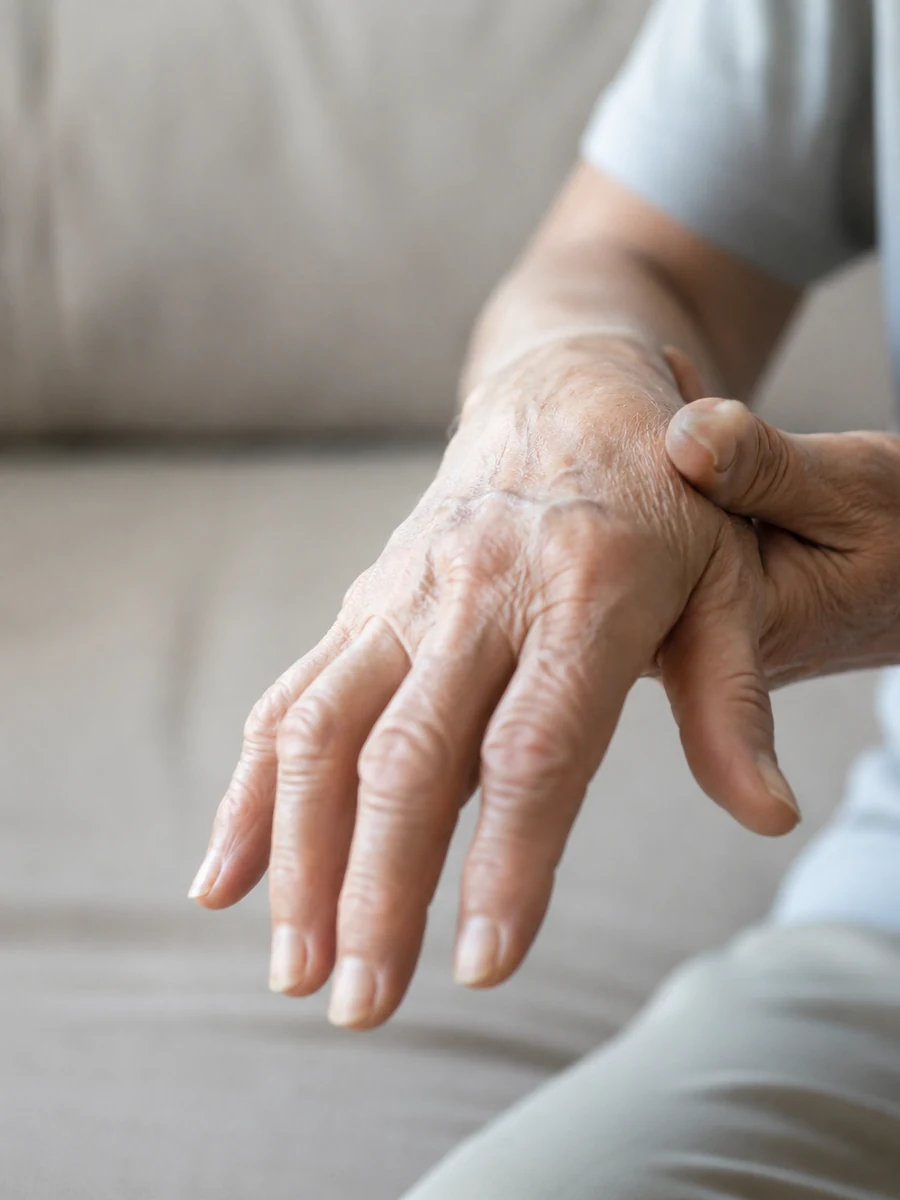 Hand affected by arthritis and joint symptoms