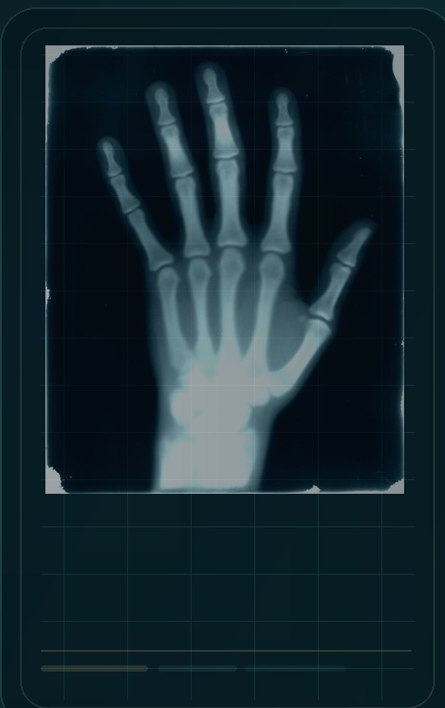 Hand and wrist X-ray used as an interactive symptom guide